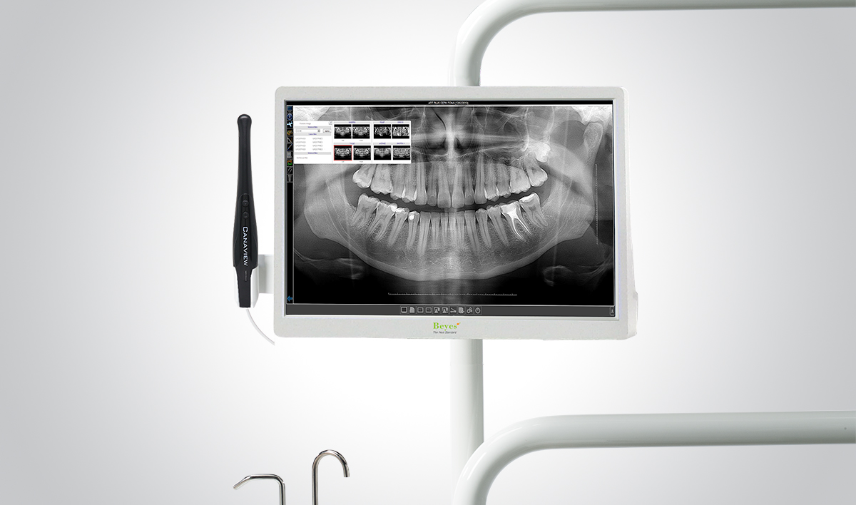 Canaview intraoral all in one system